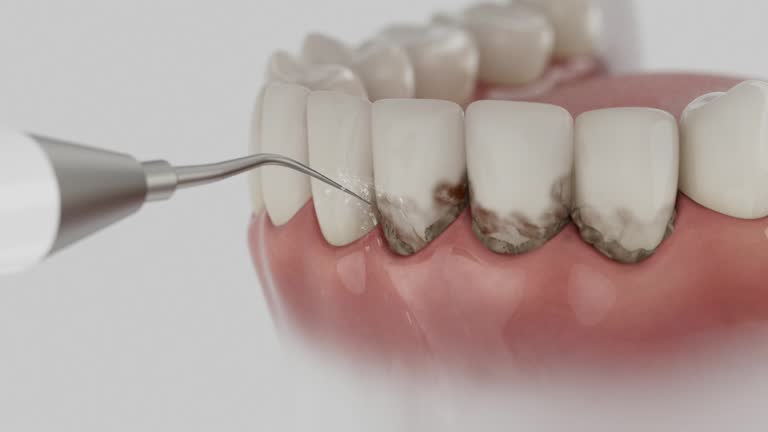 Reliable Dental Implants contractor in Enterprise, NV by Smile Center Dentistry